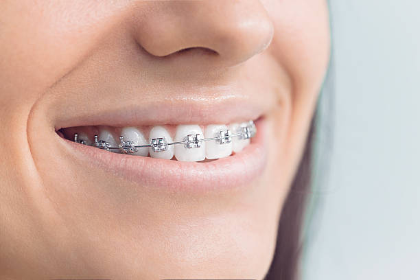 Best Full Mouth Reconstruction  in Greendale, IN
